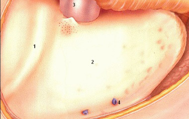 Easy Lateral Ear